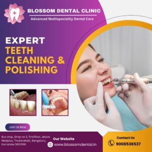 teeth cleaning and polishing